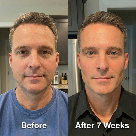 Collagen Face Sculpt Wrap (Buy 1 Get 1 FREE)