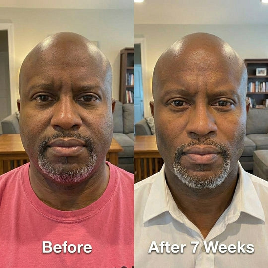 Collagen Face Sculpt Wrap (Buy 1 Get 1 FREE)