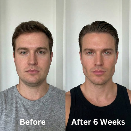 Collagen Face Sculpt Wrap (Buy 1 Get 1 FREE)